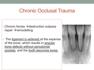 Chronic Occlusal Trauma
• Chronic forces destruction outpace
repair remodelling
• The ligament is widened at the expense
of the bone, which results in angular
bone defects without periodontal
pockets, and the tooth becomes loose.
 