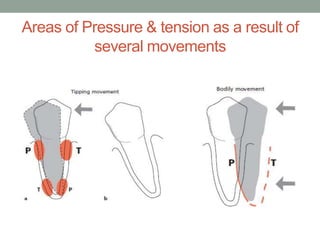 Areas of Pressure & tension as a result of
several movements
 