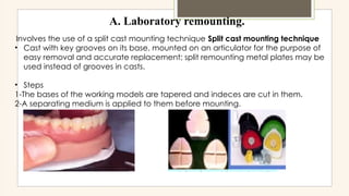 Split Cast Method occlusal surface of prosthodontics adjustment.pptx