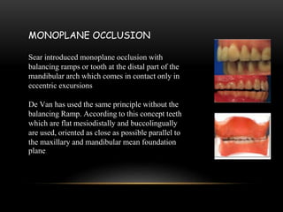 Maxillary Ramps Occlusal adjustments in cd | PPTX