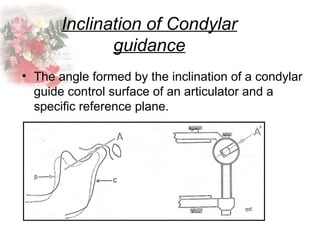 OCCLUSAL CONCEPTS IN COMPLETE DENTURE 1.ppt