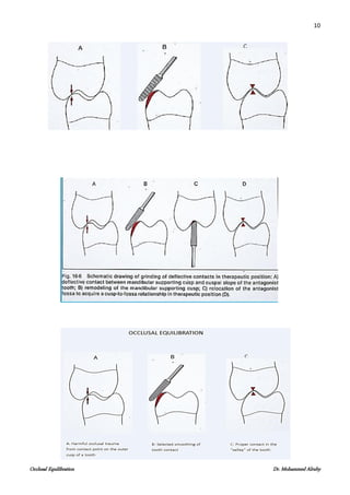 10
Occlusal Equilibration Dr. Mohammed Alruby
 