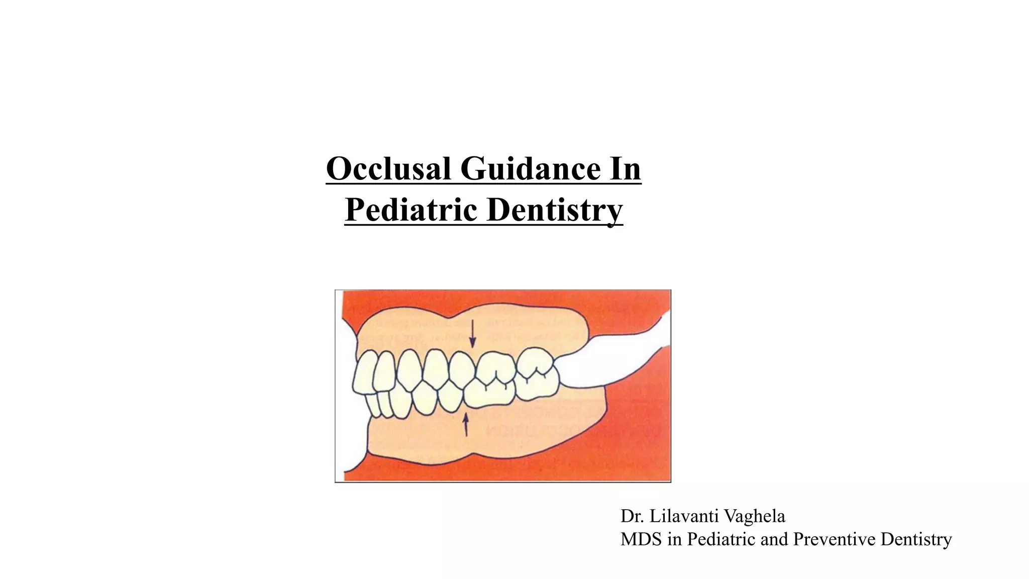 Occlusal guidance PPT