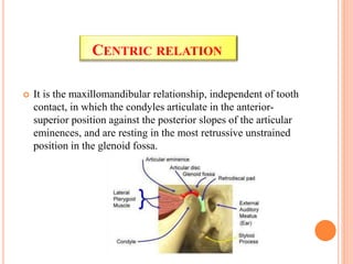 CENTRIC RELATION
 It is the maxillomandibular relationship, independent of tooth
contact, in which the condyles articulate in the anterior-
superior position against the posterior slopes of the articular
eminences, and are resting in the most retrussive unstrained
position in the glenoid fossa.
 