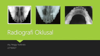 Radiografi Oklusal
drg. Neggy Yudibrata
227160027
 