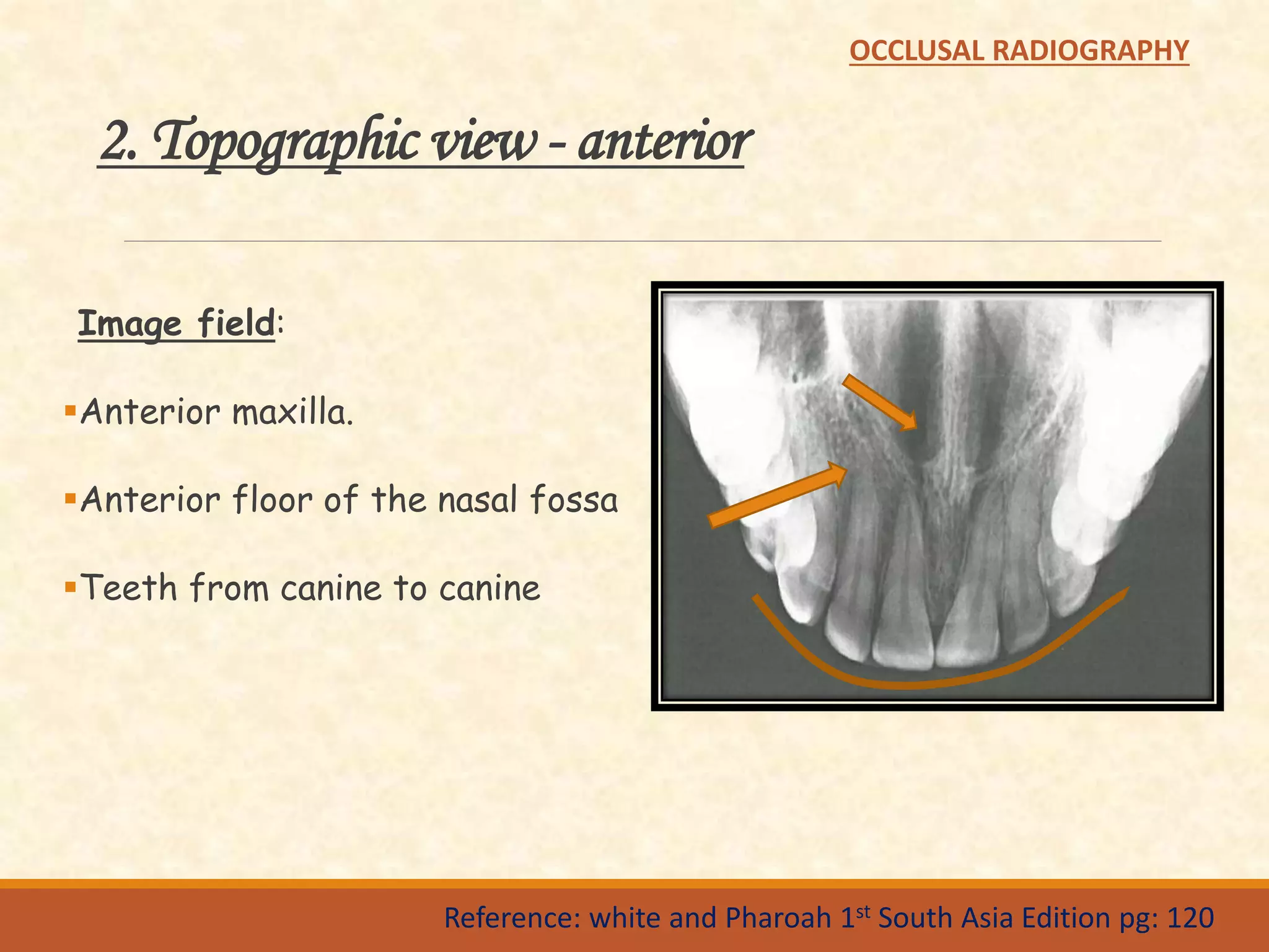 Occlusal radiography | PPTX