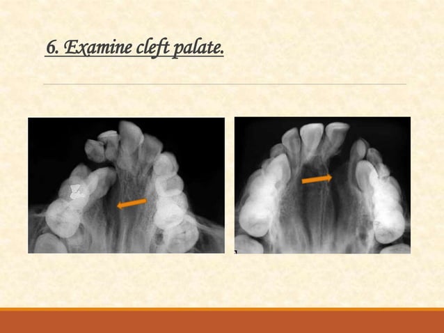Occlusal radiography | PPTX | Dental Health | Diseases and Conditions
