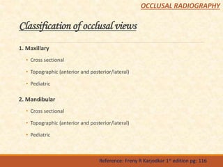 Classification of occlusal views
1. Maxillary
• Cross sectional
• Topographic (anterior and posterior/lateral)
• Pediatric
2. Mandibular
• Cross sectional
• Topographic (anterior and posterior/lateral)
• Pediatric
Reference: Freny R Karjodkar 1st edition pg: 116
OCCLUSAL RADIOGRAPHY
 