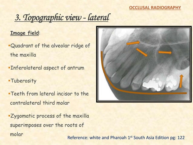 Occlusal radiography | PPTX | Dental Health | Diseases and Conditions