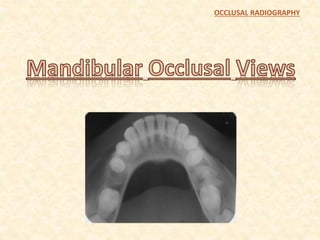 OCCLUSAL RADIOGRAPHY
 