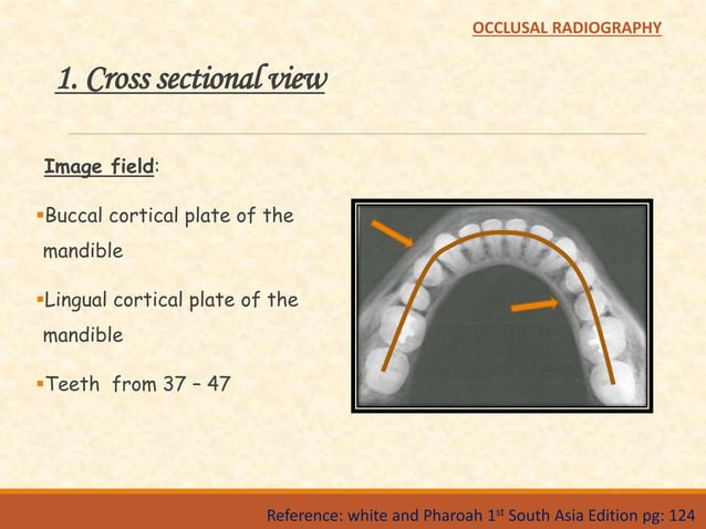 Occlusal radiography | PPTX | Dental Health | Diseases and Conditions