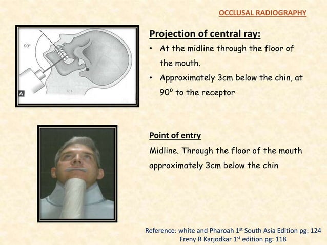 Occlusal radiography | PPTX | Dental Health | Diseases and Conditions