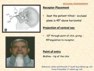 Receptor Placement
• Seat the patient tilted – occlusal
plane is 45⁰ above horizontal
Projection of central ray:
• -10⁰ through point of chin, giving -
45⁰angulation to receptor.
Reference: white and Pharoah 1st South Asia Edition pg: 123
Freny R Karjodkar 1st edition pg: 118
OCCLUSAL RADIOGRAPHY
Point of entry
Midline – tip of the chin
45⁰
 