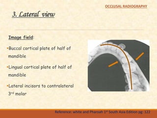 3. Lateral view
Image field:
Buccal cortical plate of half of
mandible
Lingual cortical plate of half of
mandible
Lateral incisors to contralateral
3rd molar
Reference: white and Pharoah 1st South Asia Edition pg: 122
OCCLUSAL RADIOGRAPHY
 