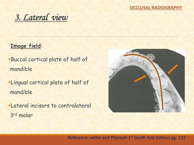 Occlusal radiography | PPTX | Dental Health | Diseases and Conditions