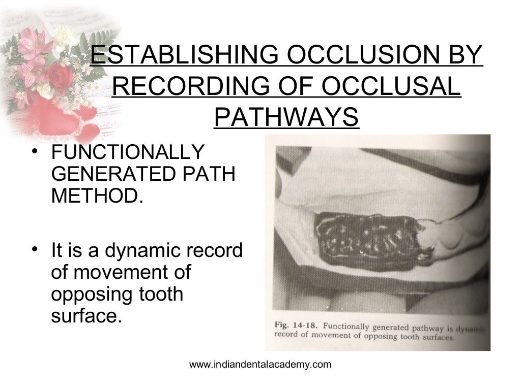 Occlusal registration in removable partial denture / orthodontic semi…