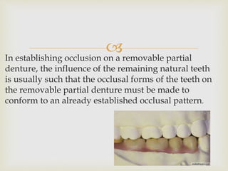In establishing occlusion on a removable partial
denture, the influence of the remaining natural teeth
is usually such that the occlusal forms of the teeth on
the removable partial denture must be made to
conform to an already established occlusal pattern.
 
