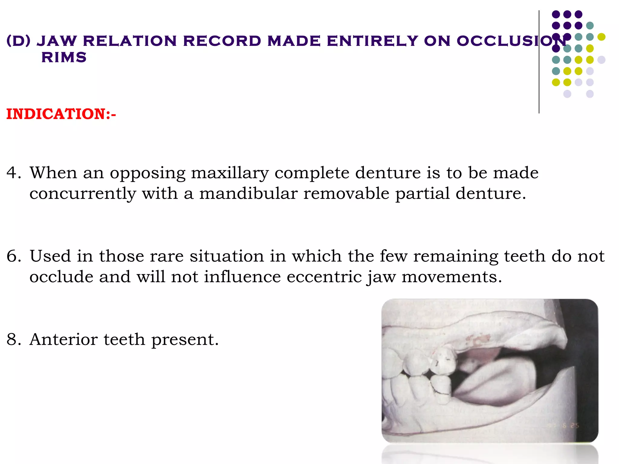 Occlusal Record Rpd Occlusal relationship in_rpd__prostho_ | PPT