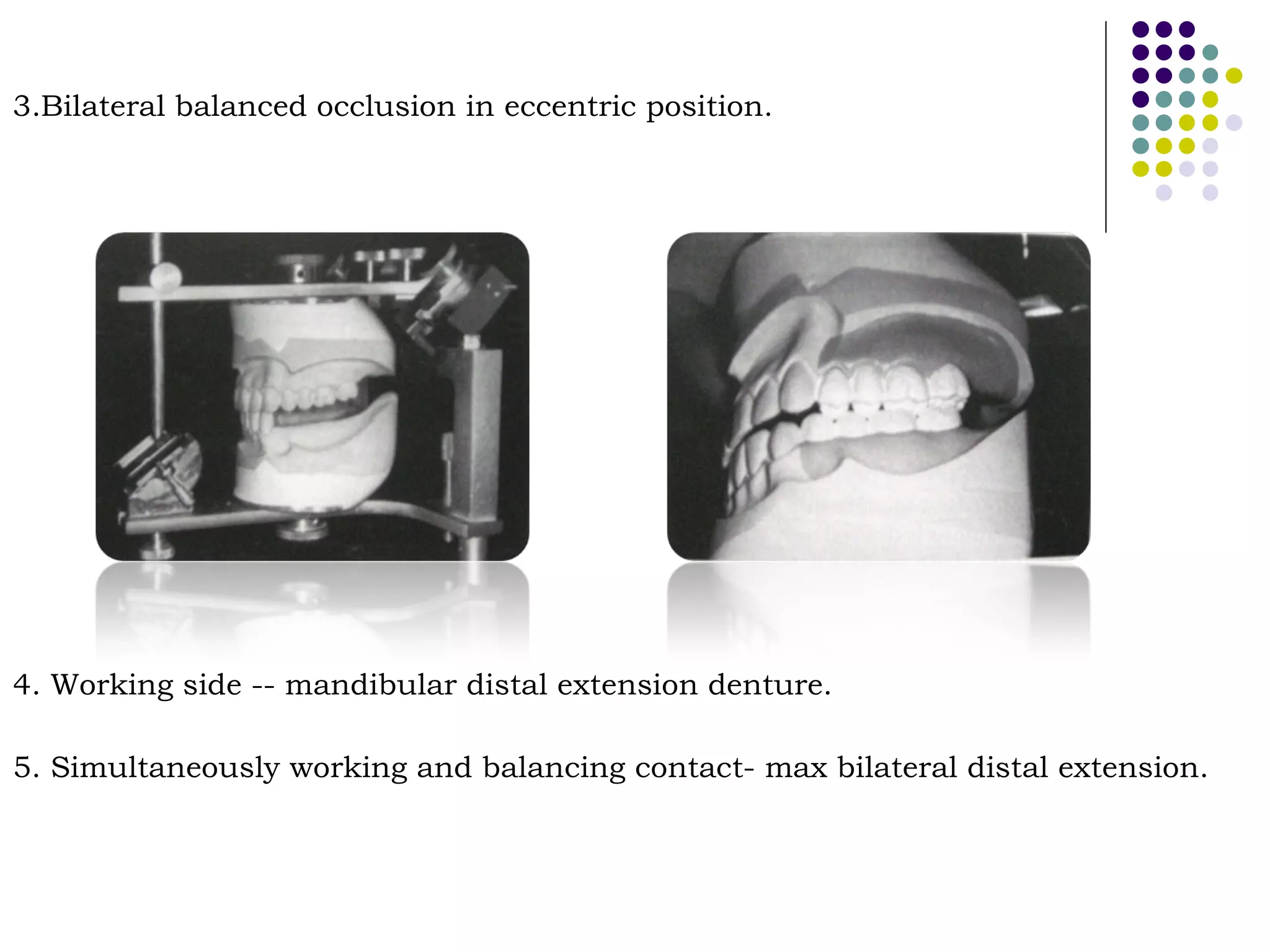 Occlusal relationship in_rpd__prostho_ | PPT