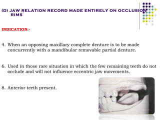 Occlusal Support Rpd Occlusal relationship in_rpd__prostho_ | PPT