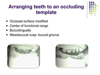 Occlusal Support Rpd Occlusal relationship in_rpd__prostho_ | PPT