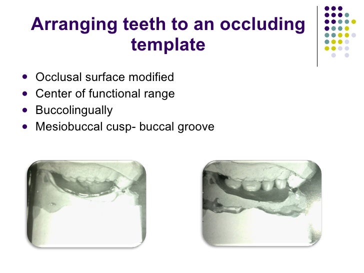 Occlusal relationship in_rpd__prostho_
