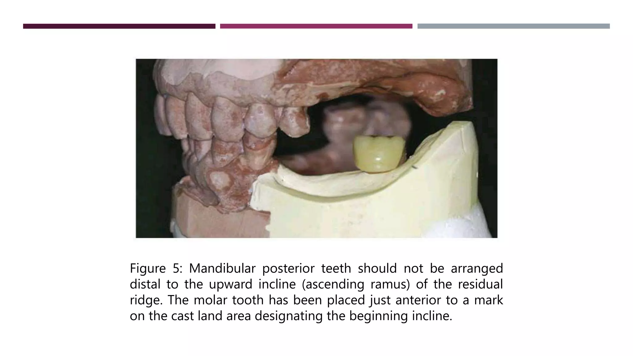 occlusal relationships for rpd -protik.pptx