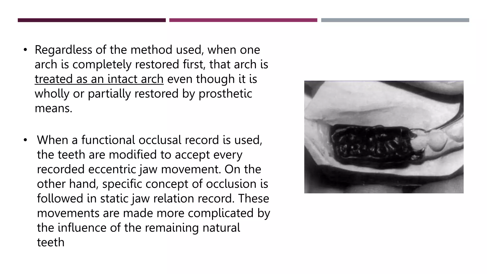 Occlusal Record Rpd occlusal relationships for rpd -protik.pptx