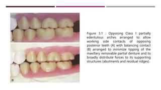 Removable Ridges occlusal relationships for rpd -protik.pptx