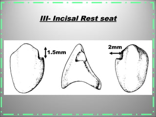 III- Incisal Rest seatIII- Incisal Rest seat
1.5mm
2mm
 