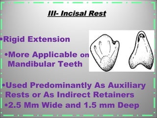 III- Incisal RestIII- Incisal Rest
•Used Predominantly As Auxiliary
Rests or As Indirect Retainers
•Rigid Extension
•More Applicable on
Mandibular Teeth
•2.5 Mm Wide and 1.5 mm Deep
 