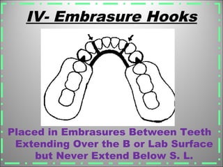IV- Embrasure Hooks
Placed in Embrasures Between Teeth
Extending Over the B or Lab Surface
but Never Extend Below S. L.
 