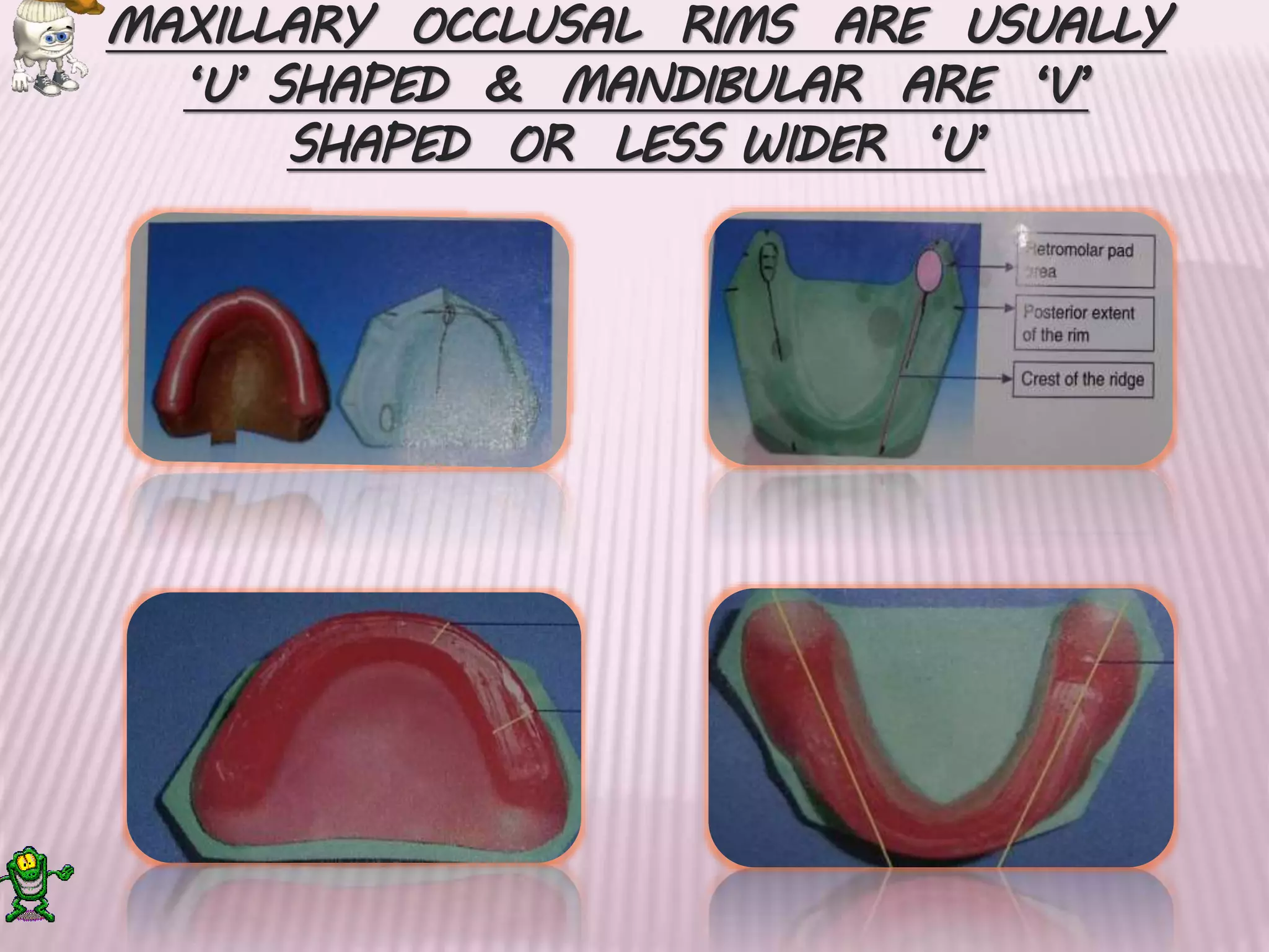 Record bases and Occlusal rims ppt | PPTX