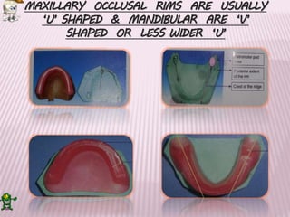 Occclusal Rims Record bases and Occlusal rims ppt | PPTX