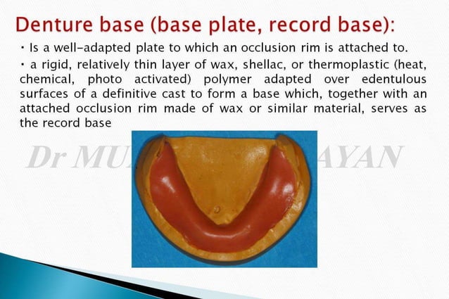 OCCLUSAL RIMS & RECORD BASE.pptx