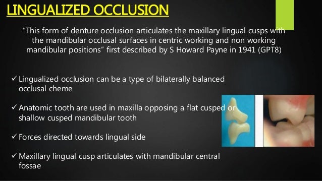 Occlusal schemes in complete denture