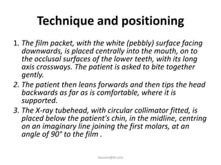 Technique and positioning
1. The film packet, with the white (pebbly) surface facing
   downwards, is placed centrally into the mouth, on to
   the occlusal surfaces of the lower teeth, with its long
   axis crossways. The patient is asked to bite together
   gently.
2. The patient then leans forwards and then tips the head
   backwards as far as is comfortable, where it is
   supported.
3. The X-ray tubehead, with circular collimator fitted, is
   placed below the patient's chin, in the midline, centring
   on an imaginary line joining the first molars, at an
   angle of 90° to the film .

                          ikassem@dr.com
 