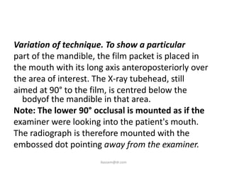 Variation of technique. To show a particular
part of the mandible, the film packet is placed in
the mouth with its long axis anteroposteriorly over
the area of interest. The X-ray tubehead, still
aimed at 90° to the film, is centred below the
  bodyof the mandible in that area.
Note: The lower 90° occlusal is mounted as if the
examiner were looking into the patient's mouth.
The radiograph is therefore mounted with the
embossed dot pointing away from the examiner.
                      ikassem@dr.com
 