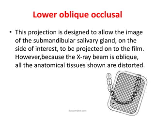 Lower oblique occlusal
• This projection is designed to allow the image
  of the submandibular salivary gland, on the
  side of interest, to be projected on to the film.
  However,because the X-ray beam is oblique,
  all the anatomical tissues shown are distorted.




                      ikassem@dr.com
 