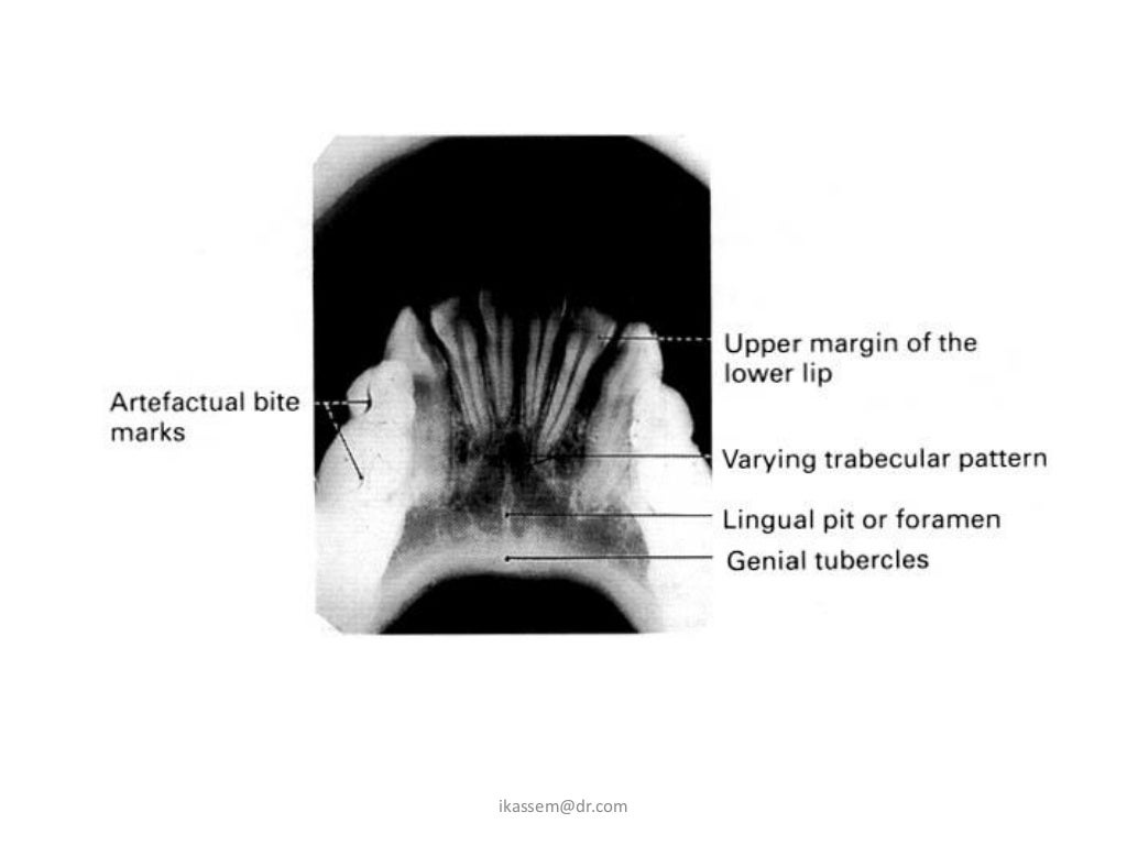 Occlusal techniques