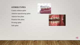 48
OTHER TYPES
Centric relation splint
Anterior repositioning splint
Anterior bite plane
Posterior bite plane
Pivoting splint
Soft splint
 