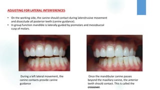 Tooth Disocclude OCCLUSAL THERAPY IN FIXED PROSTHODONTICS | PDF