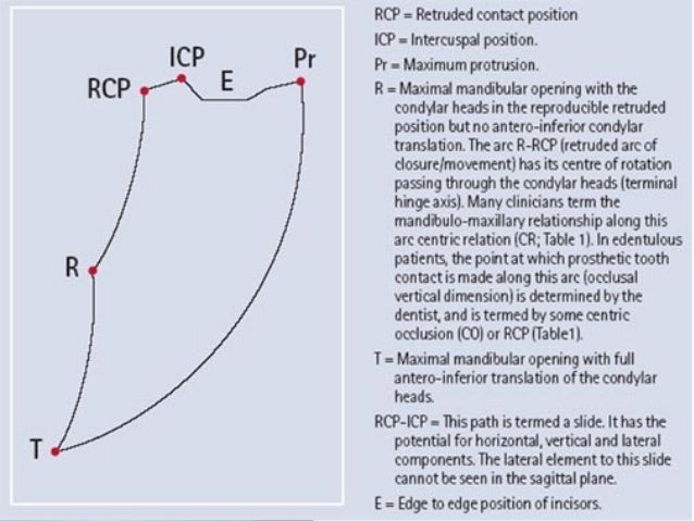 Contacts position. Схема поссельта. Правильное положение для сна. Contacts position. Contacts position.