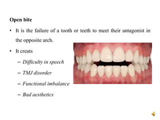 Open bite
• It is the failure of a tooth or teeth to meet their antagonist in
the opposite arch.
• It creats
– Difficulty in speech
– TMJ disorder
– Functional imbalance
– Bad aesthetics
 