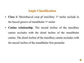 Angle Classification
• Class 1: Mesiobuccal cusp pf maxillary 1st molar occlude in
the buccal groove of mandibular 1st molar
• Canine relationship: The mesial incline of the maxillary
canine occludes with the distal incline of the mandibular
canine. The distal incline of the maxillary canine occludes with
the mesial incline of the mandibular first premolar
 