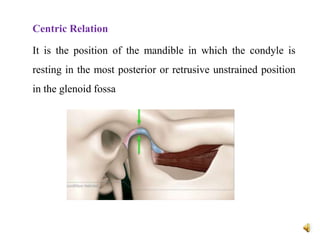 Centric Relation
It is the position of the mandible in which the condyle is
resting in the most posterior or retrusive unstrained position
in the glenoid fossa
 