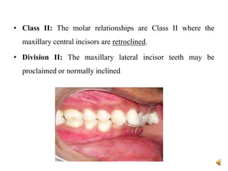 • Class II: The molar relationships are Class II where the
maxillary central incisors are retroclined.
• Division II: The maxillary lateral incisor teeth may be
proclaimed or normally inclined
 