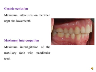 Centric occlusion
Maximum intercuspation between
uppr and lower teeth
Maximum intercuspation
Maximum interdigitation of the
maxillary teeth with mandibular
teeth
 