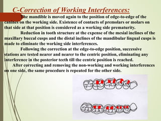 occlusion.pptx