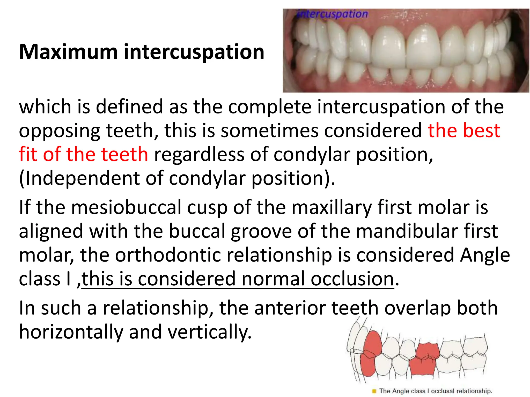 occlusion mmmmmmmm- Copy [Autosaved].pptx